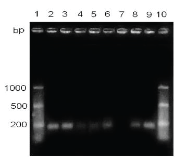 ivs-aid1012-g001